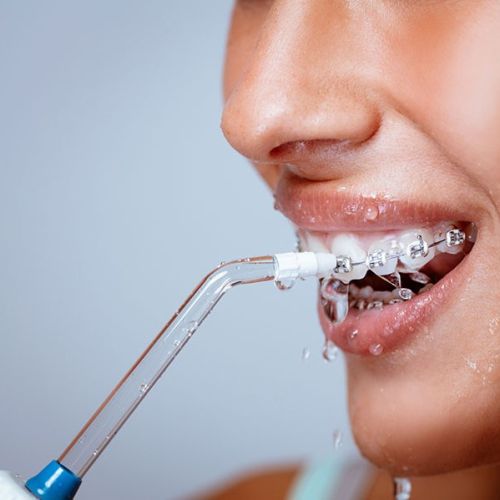 PRIZMA DENTALJet+ je oralni irigator za ispiranje zuba i desni. Preporuka stomatologa oralnog tuša za zube za čišćenje teško dostupnih površina zuba.