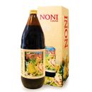 Noni Lucas sok 1l