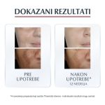 Dokazani rezultati Eucerin Anti-pigment seruma.