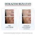 Eucerin Anti-pigment rezultati