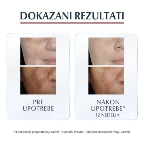 Eucerin Anti-pigment rezultati