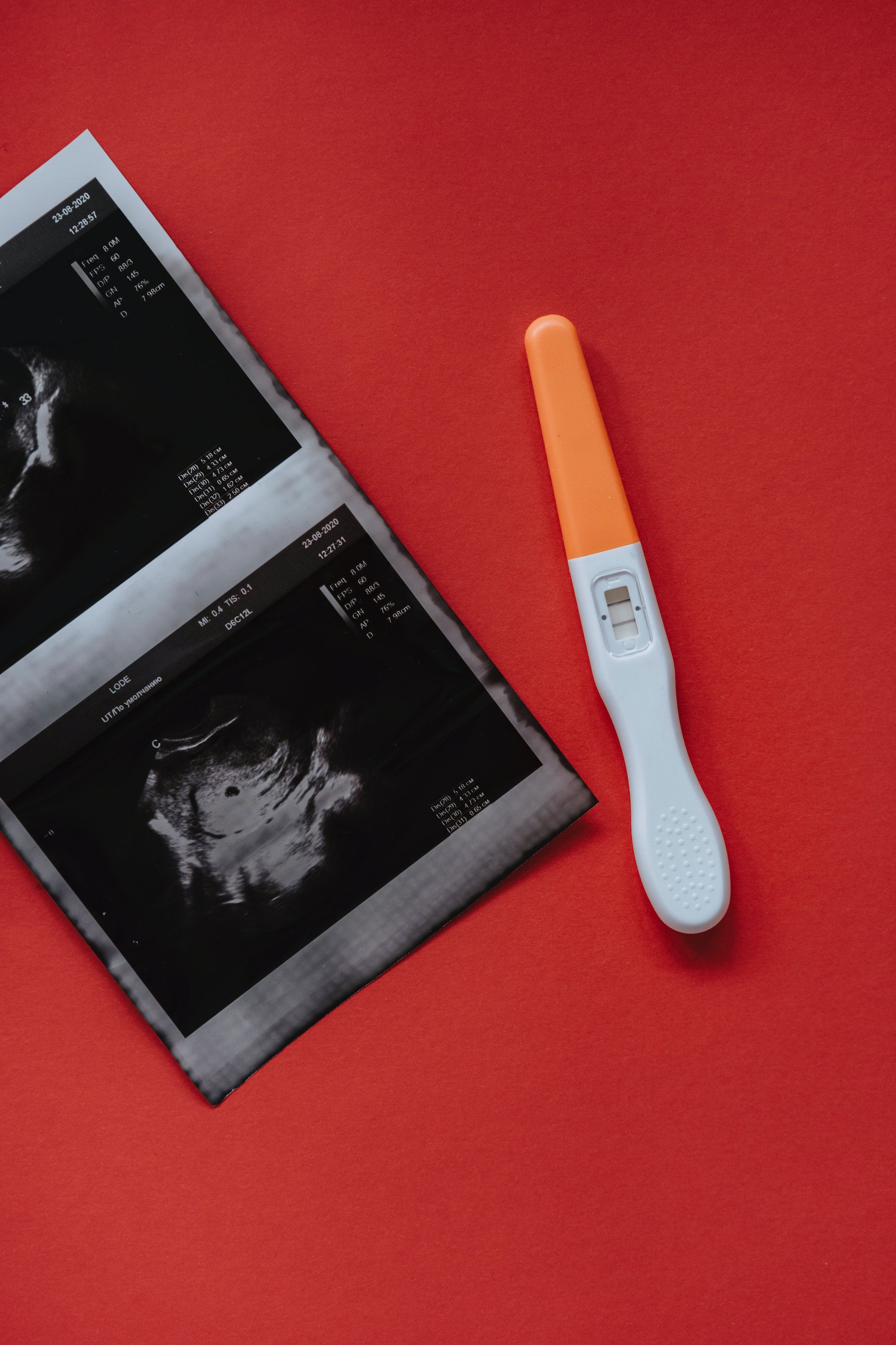 Test za trudnoću – sve što treba da znate